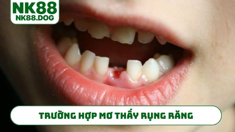 Trường hợp mơ thấy rụng răng chuẩn nhất